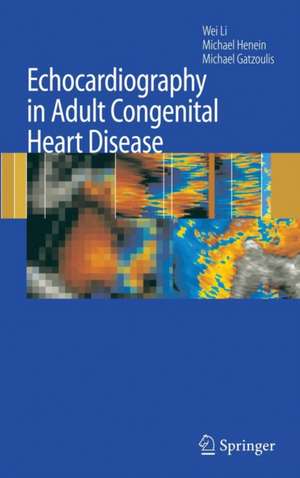 Echocardiography in Adult Congenital Heart Disease de Wei Li