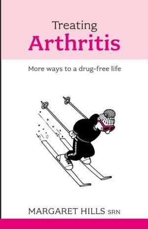 Treating Arthritis de Margaret Hills