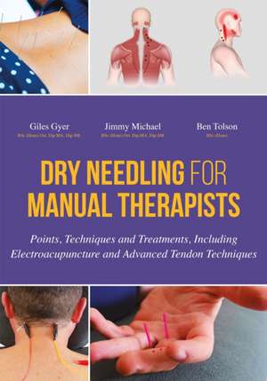 Dry Needling for Manual Therapists de Giles Gyer