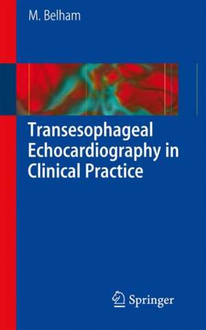 Transesophageal Echocardiography in Clinical Practice de Mark Belham