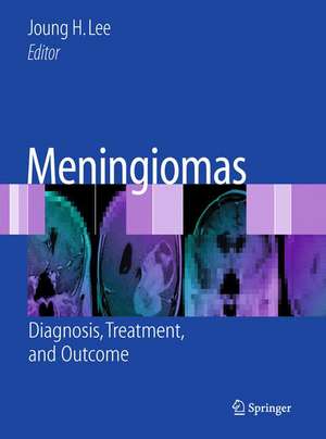 Meningiomas: Diagnosis, Treatment, and Outcome de Joung H. Lee