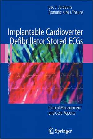 Implantable Cardioverter Defibrillator Stored ECGs: Clinical Management and Case Reports de Luc J. Jordaens