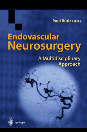 Endovascular Neurosurgery: A Multidisciplinary Approach de Paul Butler