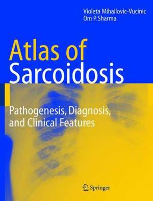 Atlas of Sarcoidosis: Pathogenesis, Diagnosis and Clinical Features de Violeta Mihailovic-Vucinic