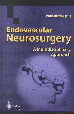 Endovascular Neurosurgery: A Multidisciplinary Approach de Paul Butler