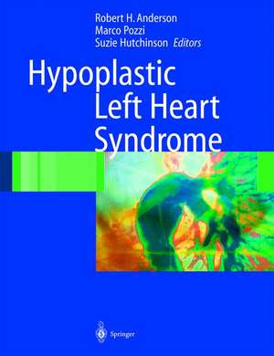 Hypoplastic Left Heart Syndrome de Robert H. Anderson