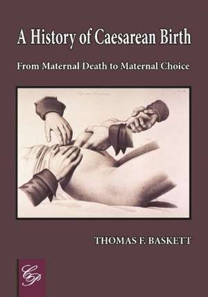 History of Caesarean Birth: From Maternal Death to Maternal Choice de Thomas F Baskett