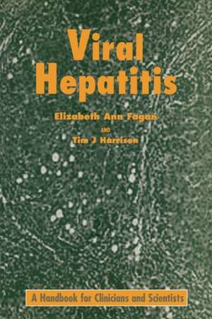 Viral Hepatitis de E.A. Fagan