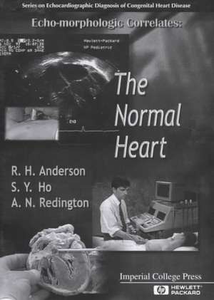Echo-Morphologic Correlates: The Normal Heart (with Video) de Robert Henry Anderson