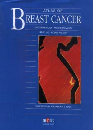 Atlas of Breast Cancer de R. W. Blamey