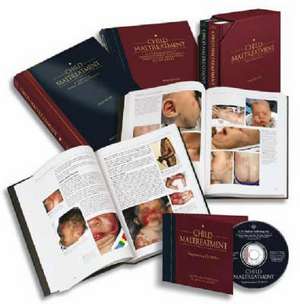 Child Maltreatment: 2-Volume Set with CD-ROM de Angelo P. Giardino