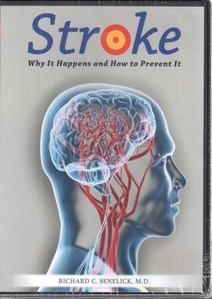 Stroke DVD: Why It Happens and How to Prevent It de Richard C. Senelick MD