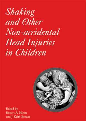 Shaking and Other Non–Accidental Head Injuries in Children de RA Minns