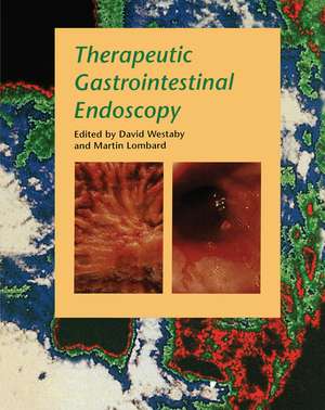 Therapeutic Gastrointestinal Endoscopy de David Westaby