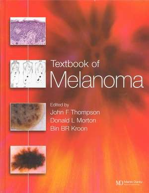 Textbook of Melanoma: Pathology, Diagnosis and Management de John F. Thompson