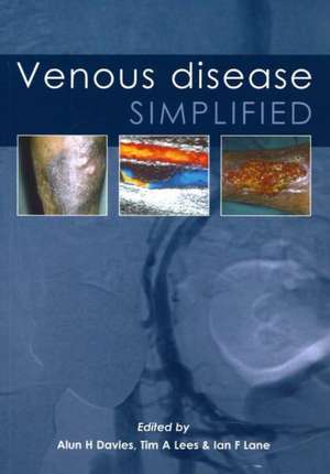 Venous Disease Simplified de H. Davies