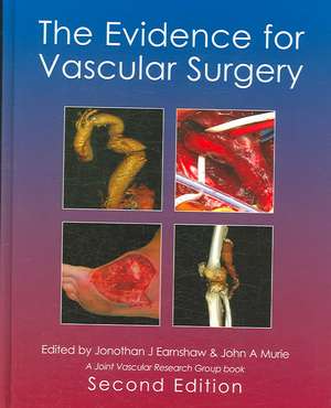 Evidence for Vascular Surgery: Court, Church and Conflict de Jonothan J. Earnshaw