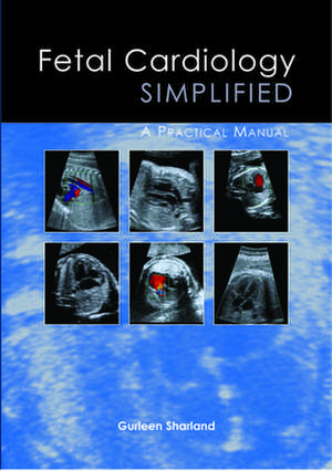 Fetal Cardiology Simplified de Gurleen Sharland