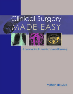 Clinical Surgery Made Easy de MS FRCS de Silva, Professor Mohan