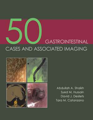 50 Gastrointestinal Cases & Associated Imaging de MD Shaikh, Abdullah A.