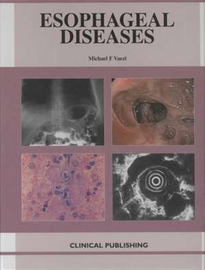 Esophageal Diseases de M. Vaizi