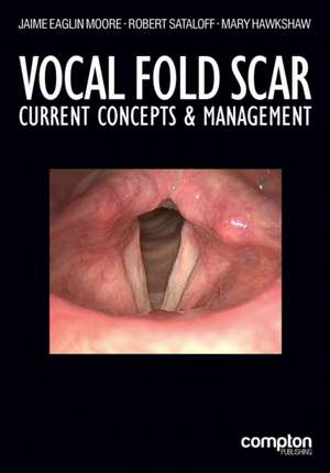 Vocal Fold Scar: Current Concepts and Management de Jaime Eaglin Moore