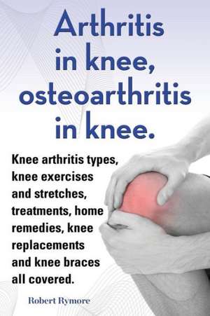 Arthritis in Knee, Osteoarthritis in Knee. Knee Arthritis Types, Knee Exercises and Stretches, Treatments, Home Remedies, Knee Replacements and Knee B: Datos E Informacion.Cuidado, Cria, Jaulas, Ser Propietario, Casa, Hogares, Alimento, Alime de Robert Rymore