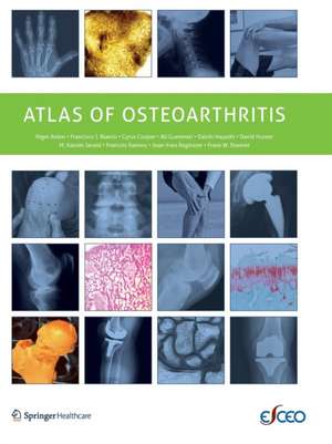 Atlas of Osteoarthritis de Nigel Arden