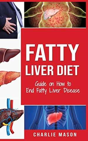 Fatty Liver Diet de Charlie Mason