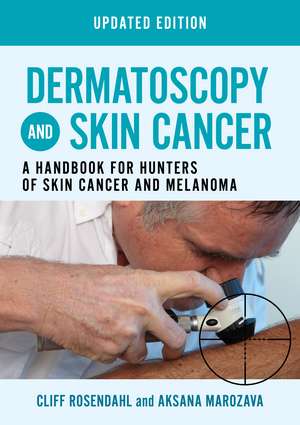 Dermatoscopy and Skin Cancer, updated edition: A handbook for hunters of skin cancer and melanoma de Cliff Rosendahl