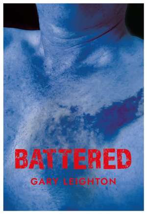 Battered de Gary Leighton