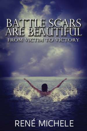 Battle Scars Are Beautiful de René Michele