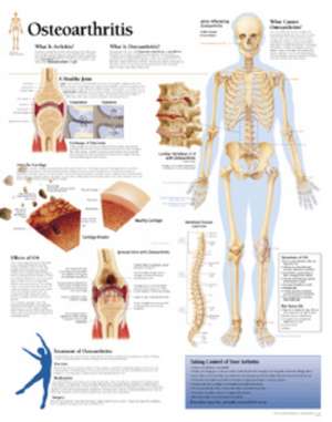 Osteoarthritis Laminated Poster de Scientific Publishing