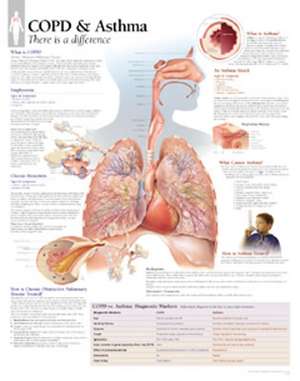 Copd/Asthma Chart: Laminated Wall Chart de Scientific Publishing