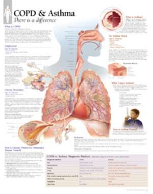 COPD & Asthma Laminated Poster de Scientific Publishing