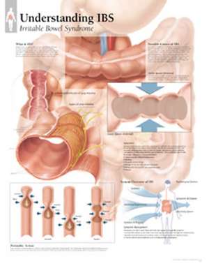 Understanding Ibs Chart: Wall Chart de Scientific Publishing