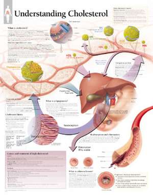 Understanding Cholesterol Chart: Wall Chart de Scientific Publishing