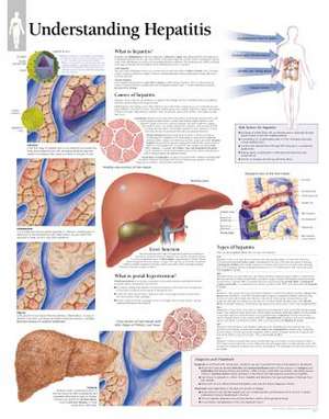 Understanding Hepatitis Chart: Laminated Wall Chart de various