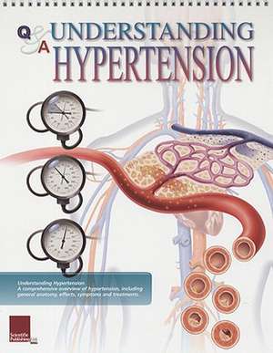 Understanding Hypertension Flip Chart de Scientific Publishing