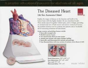 Life Size Diseased Heart Model de Scientific Publishing