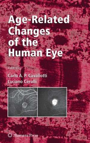 Age-Related Changes of the Human Eye de Carlo Cavallotti