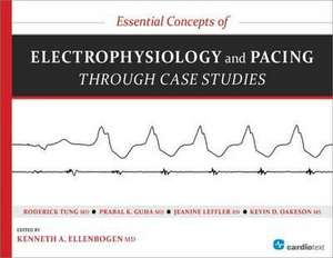 Essential Concepts of Electrophysiology and Pacing Through Case Studeies