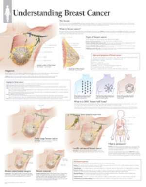 Understanding Breast Cancer Paper Poster de Scientific Publishing