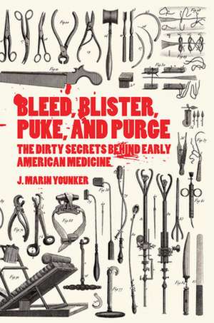 Bleed, Blister, Puke, and Purge de J Marin Younker