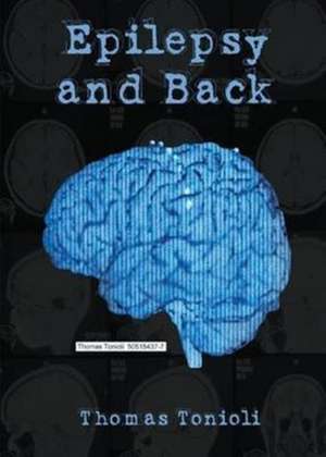 Epilepsy and Back de Thomas Tonioli