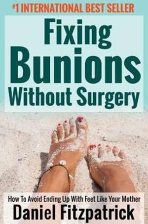 Fixing Bunions Without Surgery de Daniel Fitzpatrick