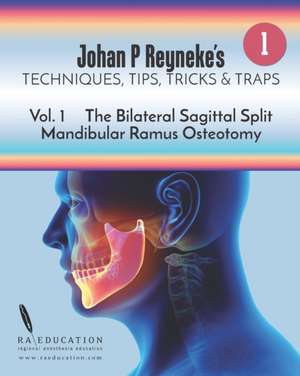 Johan P Reyneke's Techniques, Tips, Tricks and Traps: Volume 1: The Bilateral Sagittal Split Mandibular Ramus Osteotomy de Johan P. Reyneke