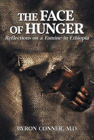 The Face of Hunger de Byron Conner M. D.