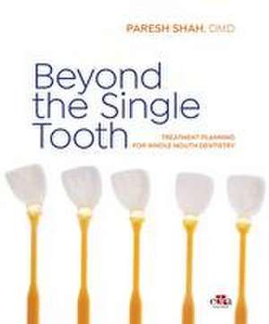 Beyond the Single Tooth de Paresh Shah