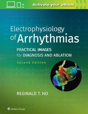 Electrophysiology of Arrhythmias: Practical Images for Diagnosis and Ablation de Reginald T. Ho MD